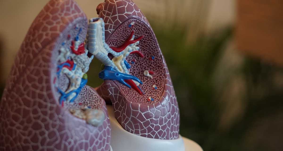 Strategies for Better Lungs